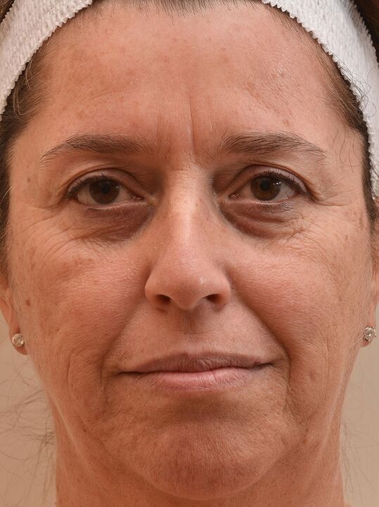 Entón mirei antes de usar a crema Eudalie