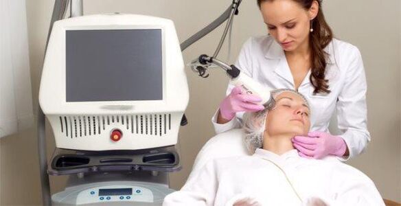 Realizando o procedemento