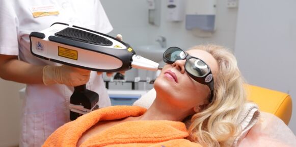 Levantamento despois de trinta anos