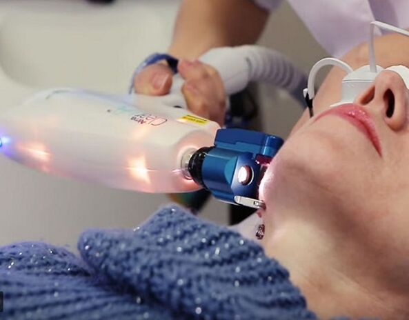 Loita contra as imperfeccións da pel